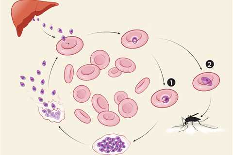 Malarial Host-Parasite Clash Causes Deadly Blood Sugar Drop