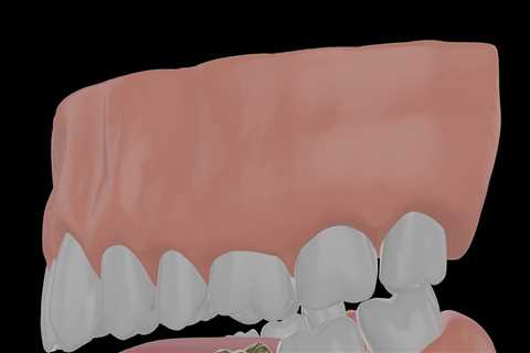 The Importance Of Quality Personal Protective Equipment During A Dental Crown Procedure In London