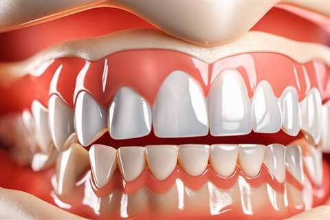 Implant Supported Dentures: What You Need to Know