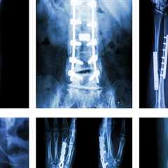 Musculoskeletal Imaging Services in Franklin, Tennessee: Get the Best Care