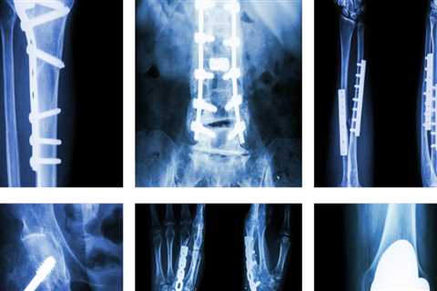 Musculoskeletal Imaging Services in Franklin, Tennessee: Get the Best Care