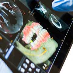 Smart Solutions For Smiles: Integrating Artificial Intelligence In Healthcare In Dental Implants In ..