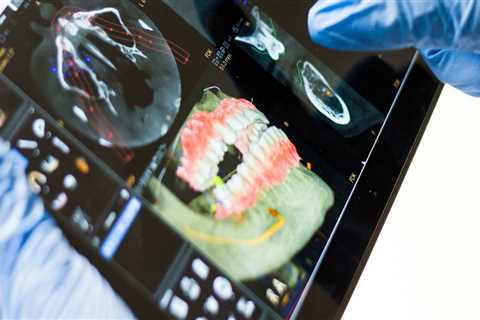 Smart Solutions For Smiles: Integrating Artificial Intelligence In Healthcare In Dental Implants In ..