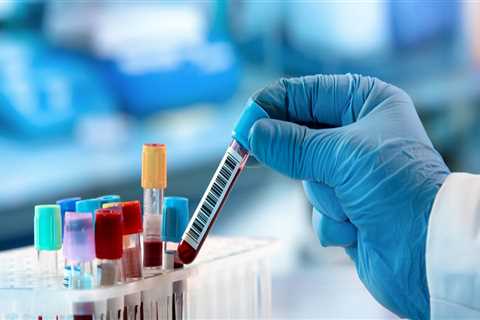 The Importance of Timely Medical Testing in Clark County, Washington: An Expert's Perspective